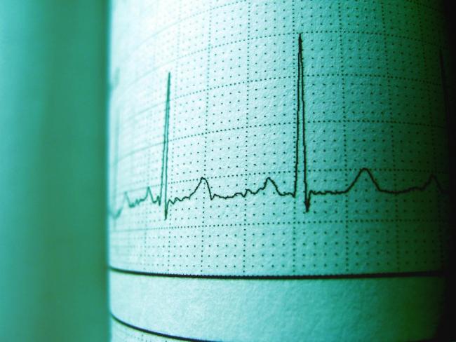 ACCIDENT CARDIAQUE EN SERVICE : L’ÉTAT ANTÉRIEUR SUFFIT-IL ?